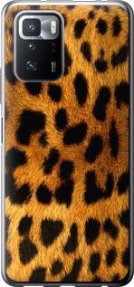 Чехол на Xiaomi Poco X3 GT Шкура леопарда