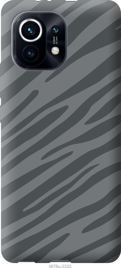 Чохол на Xiaomi Mi 11 Сіра зебра