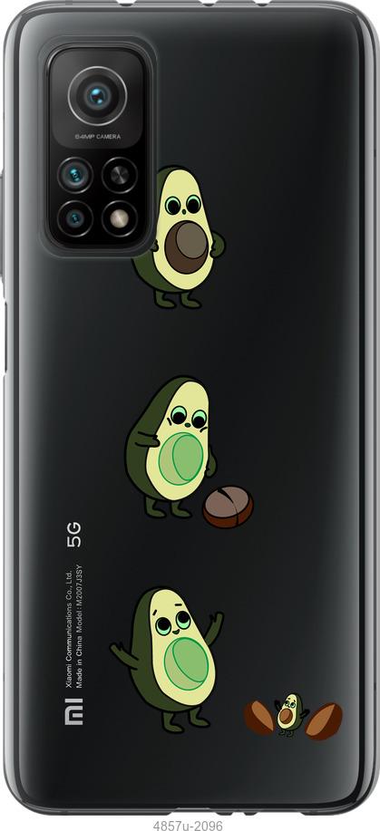 

Чохол на Xiaomi Mi 10T Авокадо 1