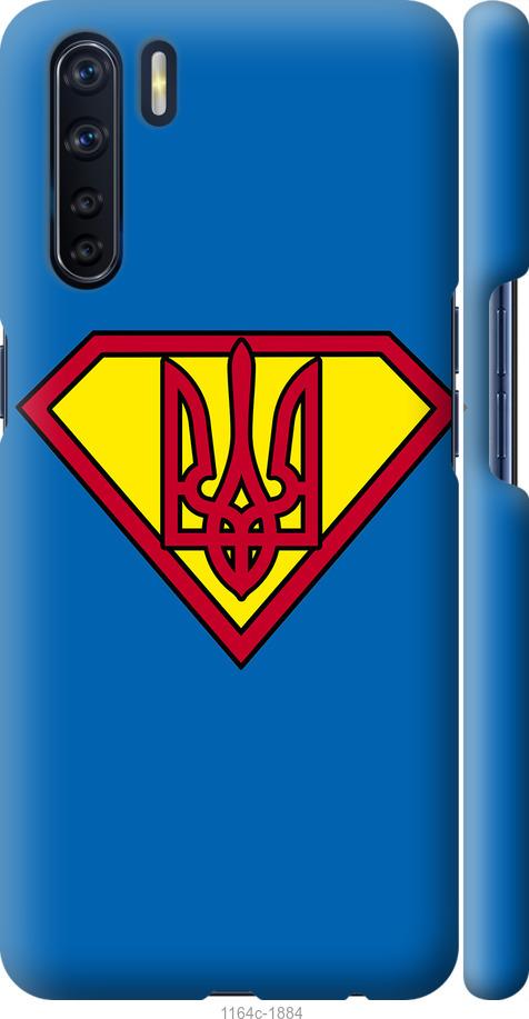

Чохол на Oppo A91 Супер Тризуб