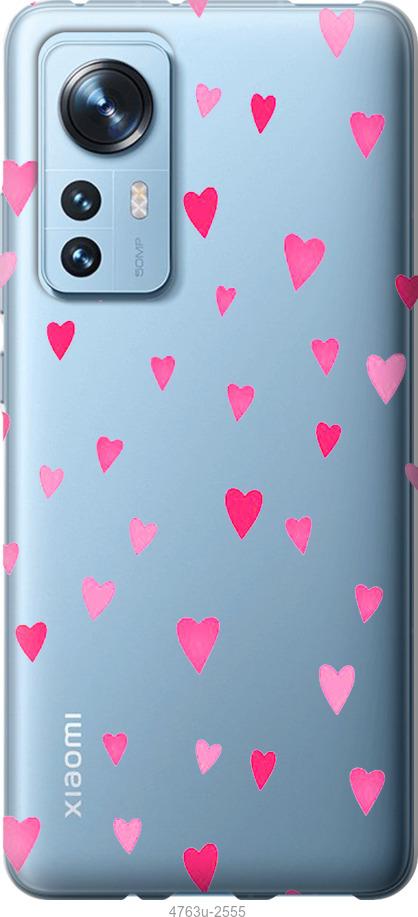 Чехол на Xiaomi 12 Сердечки 2
