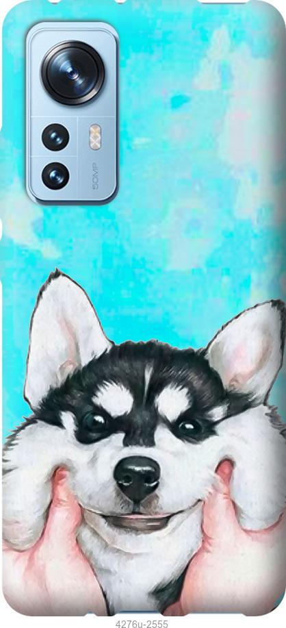 

Чехол на Xiaomi 12 Улыбнись