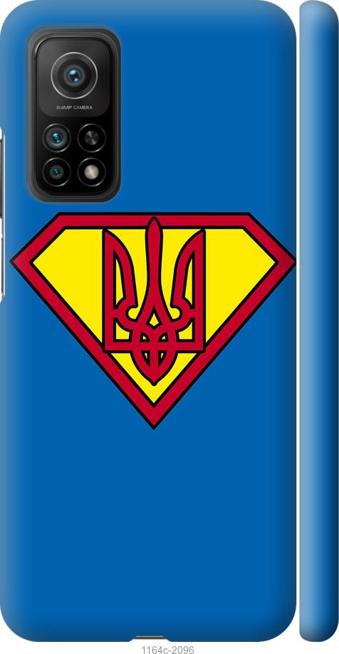 

Чохол на Xiaomi Mi 10T Супер Тризуб