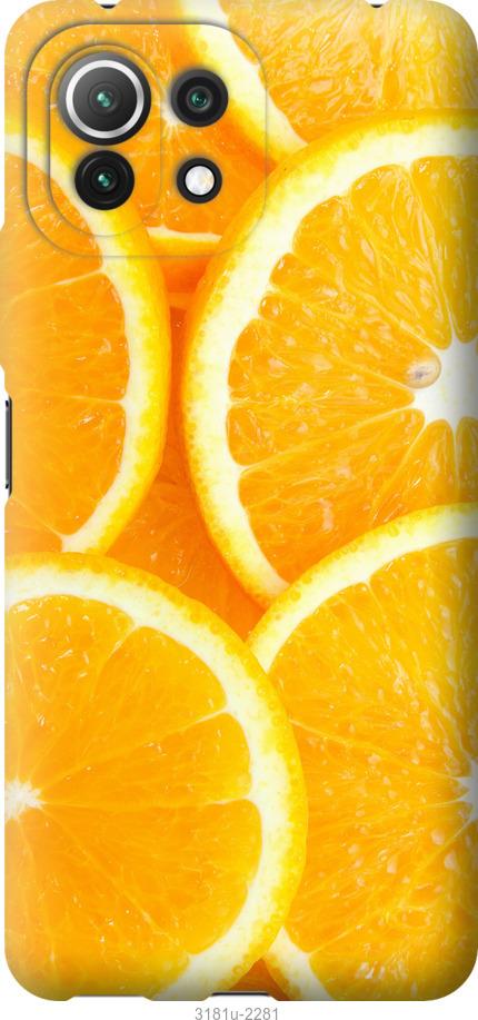 

Чохол на Xiaomi Mi 11 Lite Частки апельсина
