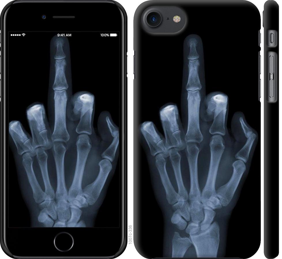 

Чохол на iPhone 7 Рука через рентген