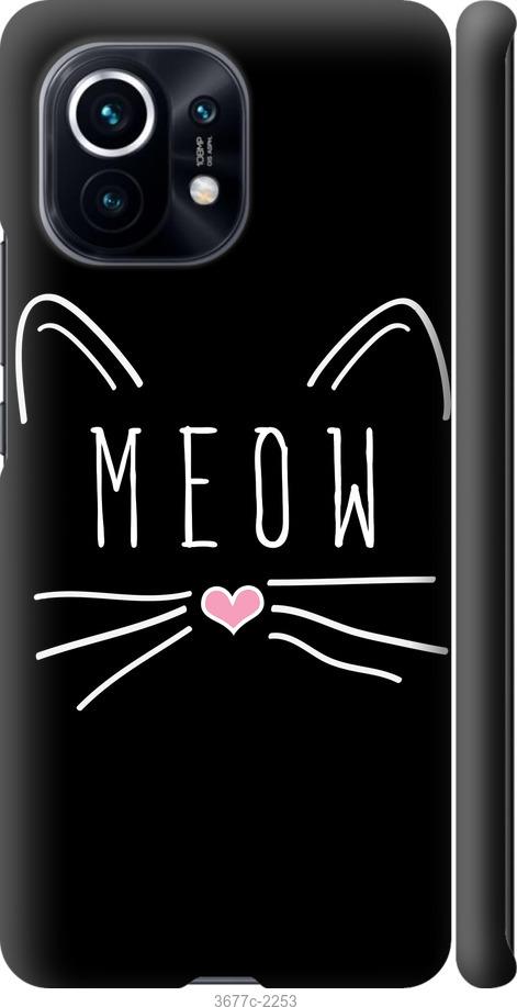 

Чехол на Xiaomi Mi 11 Kitty