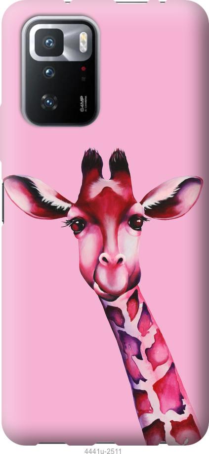 Чехол на Xiaomi Poco X3 GT Розовая жирафа