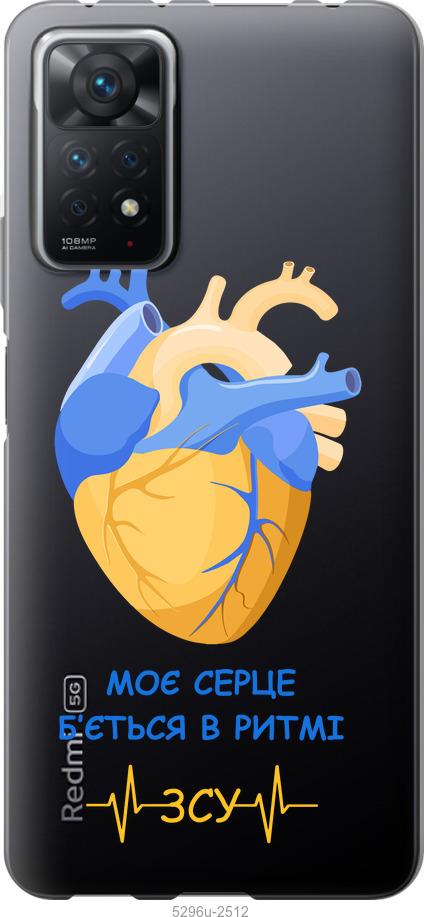 

Чохол на Xiaomi Redmi Note 11 Pro Серце v2