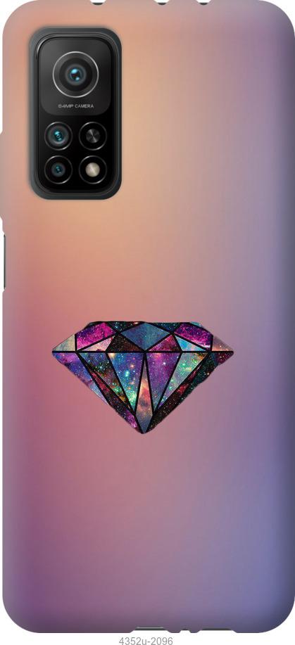 

Чохол на Xiaomi Mi 10T Діамант