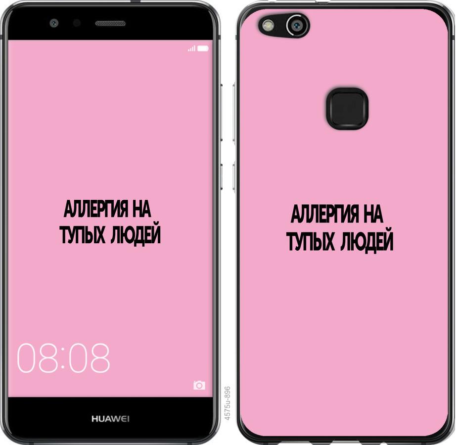 

Чохол на Huawei P10 Lite алергія