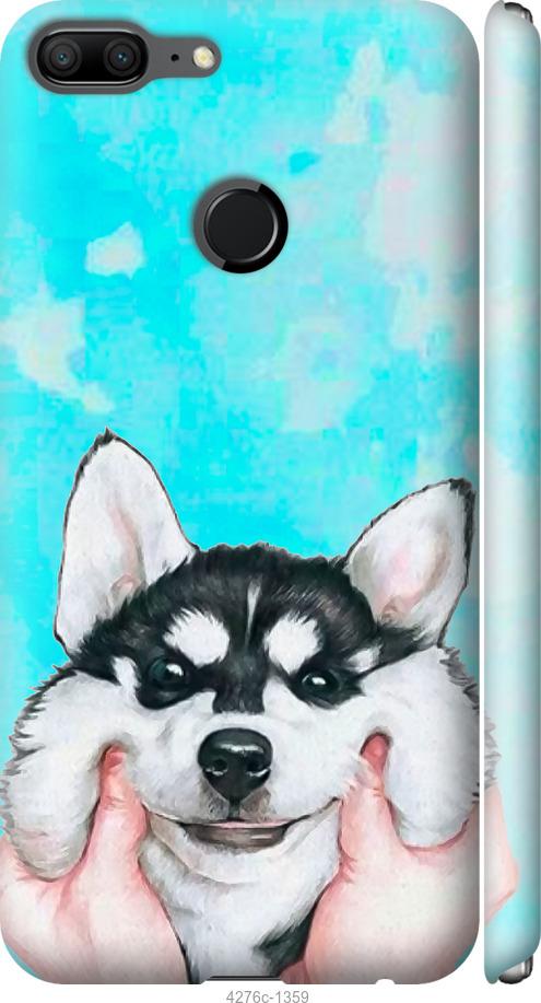 

Чехол на Huawei Honor 9 Lite Улыбнись