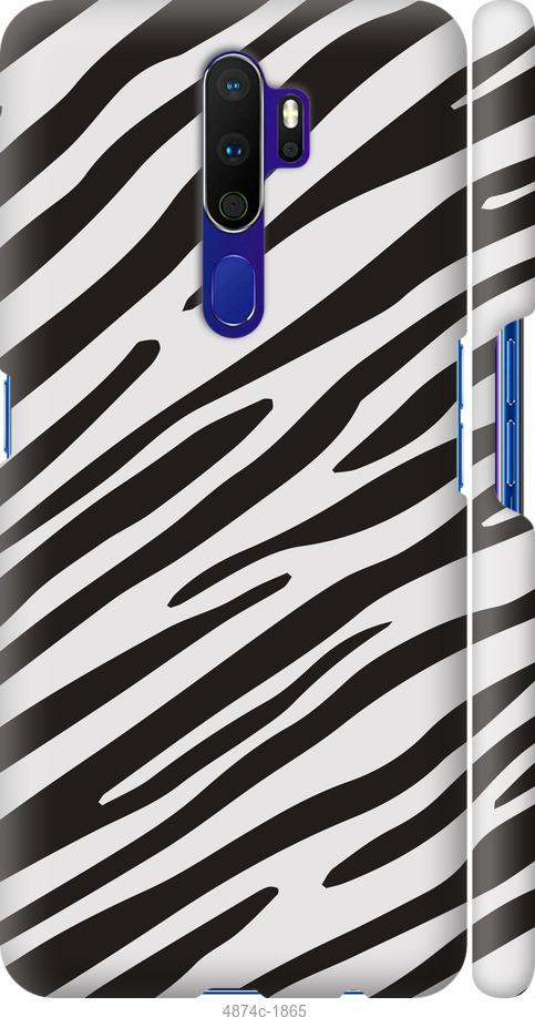 

Чохол на Oppo A9 2020 Класична зебра