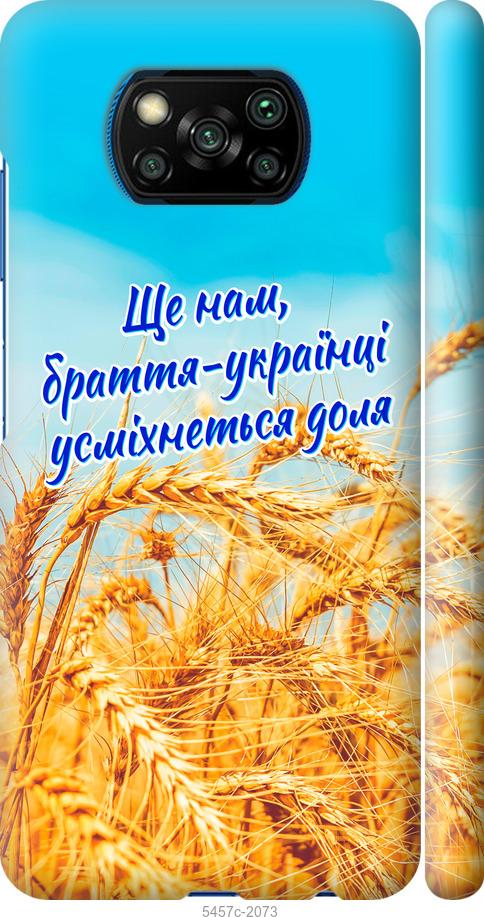 

Чохол на Xiaomi Poco X3 Україна v7