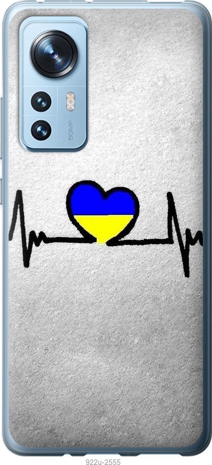 

Чохол на Xiaomi 12 Євромайдан 5