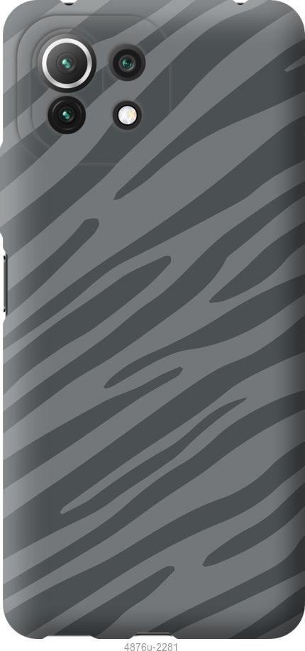 Чохол на Xiaomi Mi 11 Lite Сіра зебра