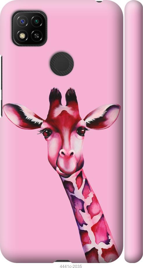 Чехол на Xiaomi Redmi 10A Розовая жирафа