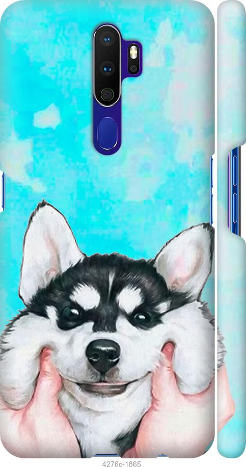 

Чехол на Oppo A9 2020 Улыбнись