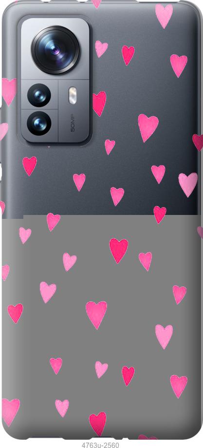 Чехол на Xiaomi 12 Pro Сердечки 2