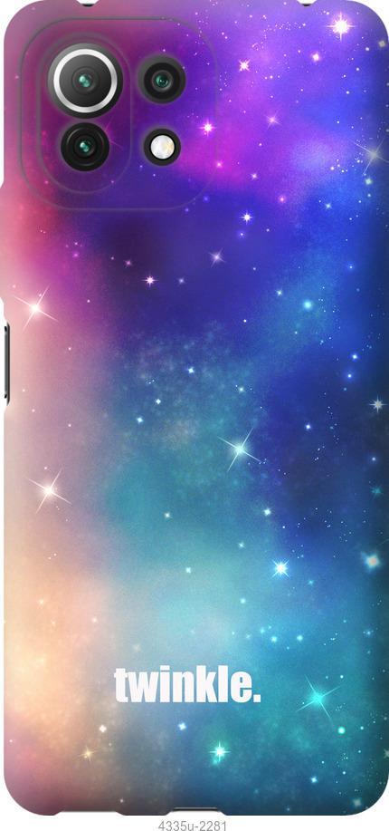 

Чохол на Xiaomi Mi 11 Lite Мерехтіння