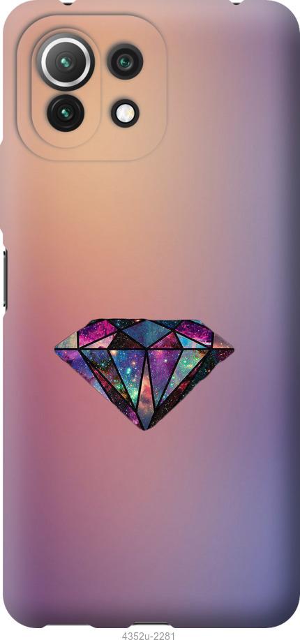 

Чохол на Xiaomi Mi 11 Lite Діамант
