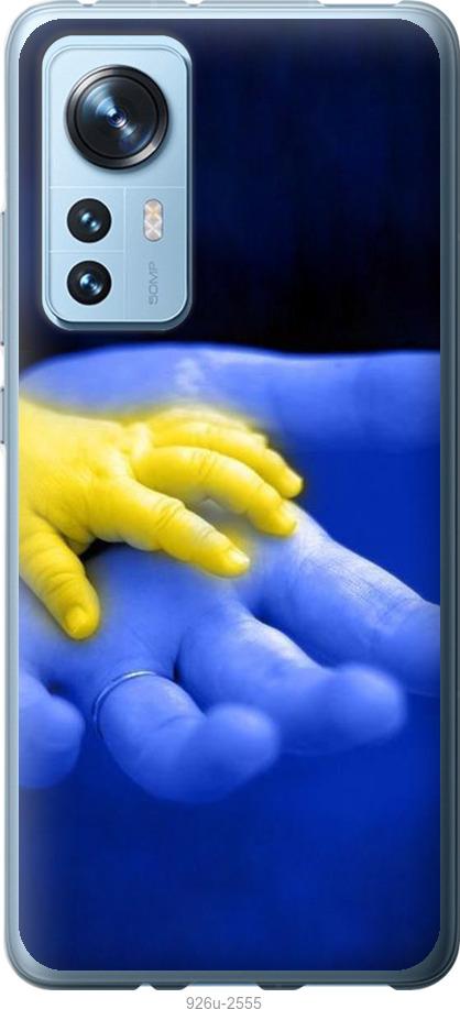 

Чехол на Xiaomi 12 Евромайдан 8