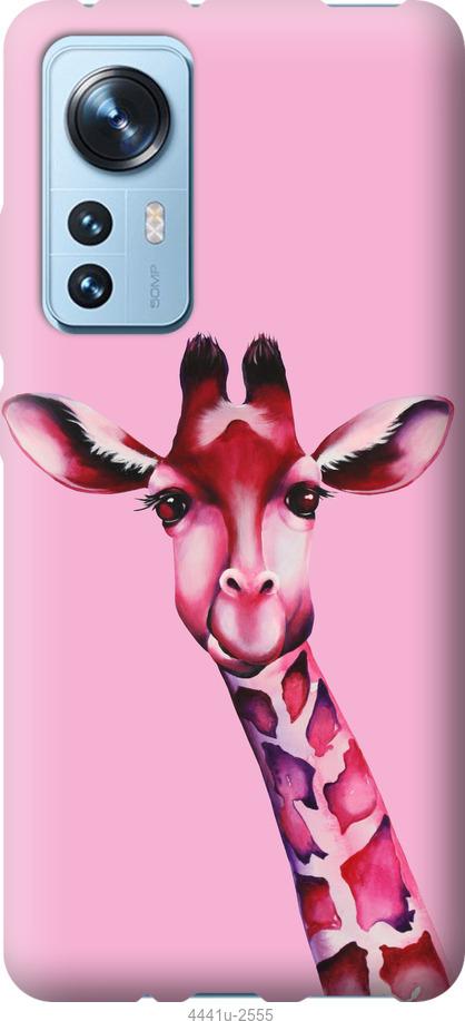 Чехол на Xiaomi 12 Розовая жирафа
