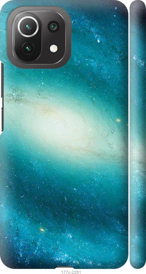 Чехол на Xiaomi Mi 11 Lite Голубая галактика