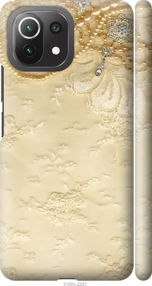 

Чехол на Xiaomi Mi 11 Lite Кружевной орнамент