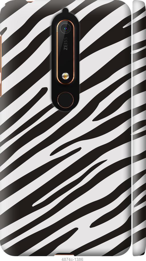

Чехол на Nokia 6.1 Классическая зебра