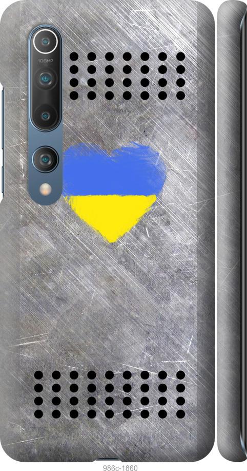 

Чохол на Xiaomi Mi 10 Щит 2