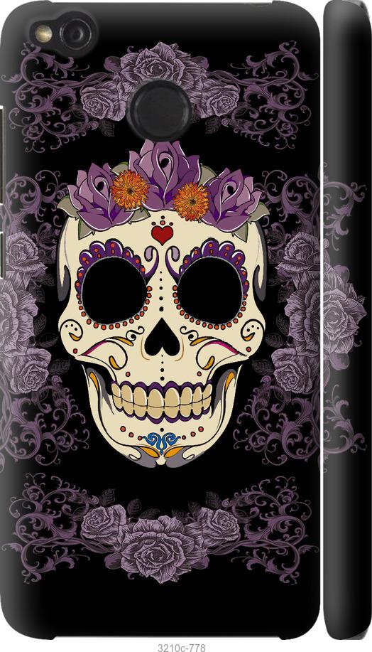 Чохол на Xiaomi Redmi 4X Sugarskull