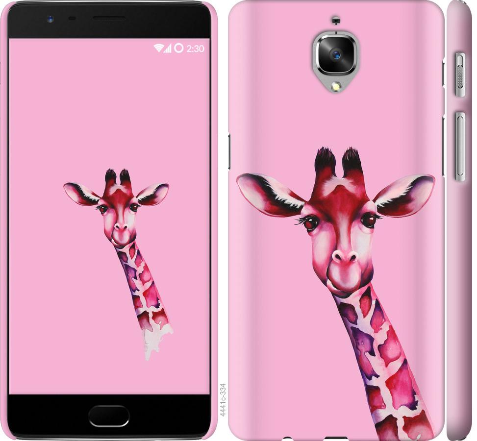 

Чохол на OnePlus 3T Рожева жирафа