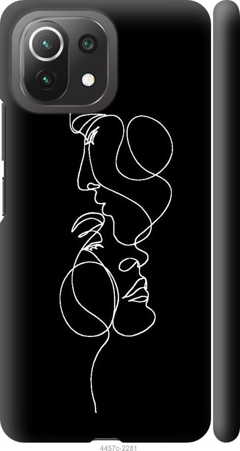 

Чехол на Xiaomi Mi 11 Lite Пара
