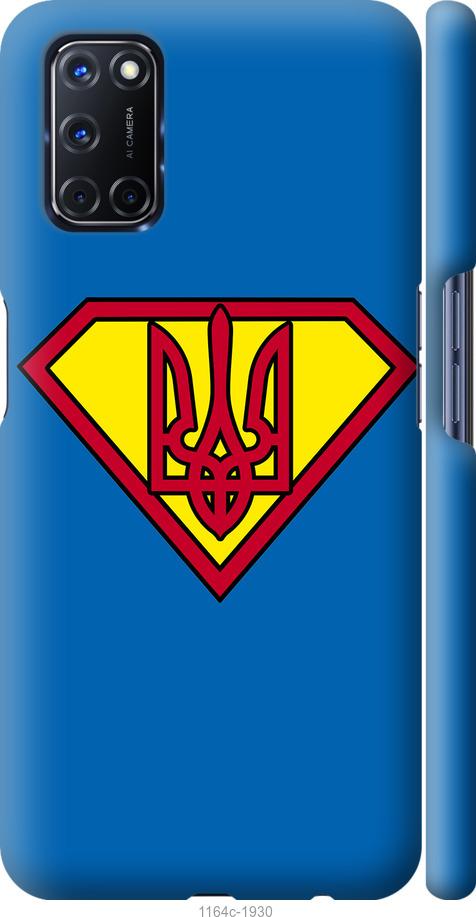 

Чохол на Oppo A52 Супер Тризуб