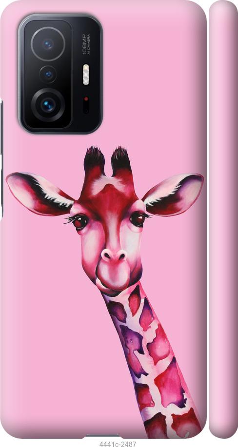 Чехол на Xiaomi 11T Розовая жирафа