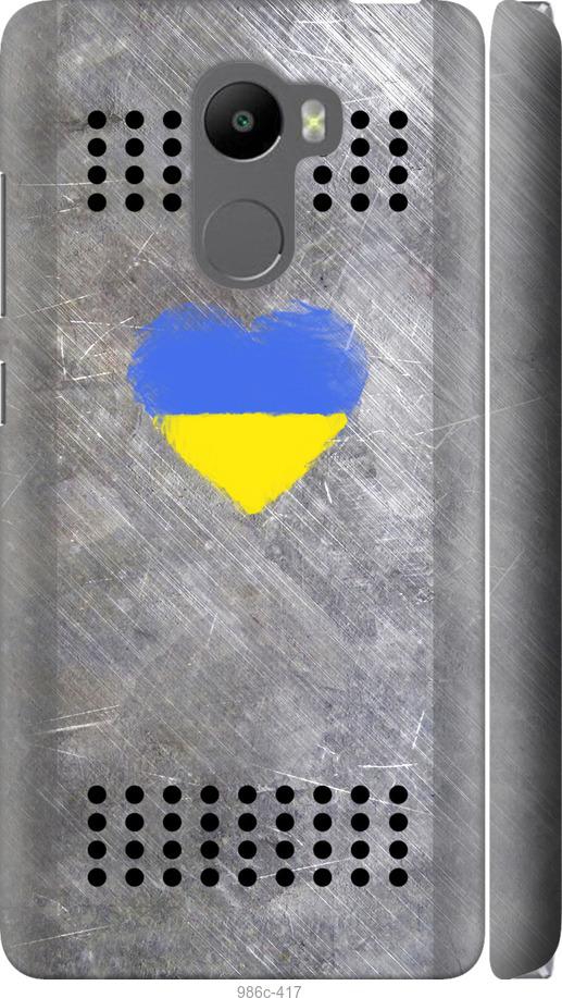 

Чохол на Xiaomi Redmi 4 Щит 2