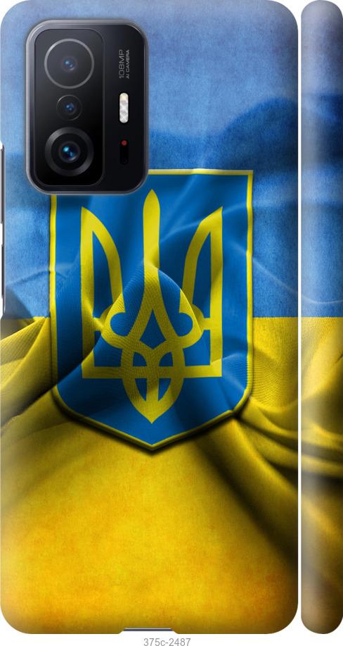 

Чохол на Xiaomi 11T Прапор та герб України 1