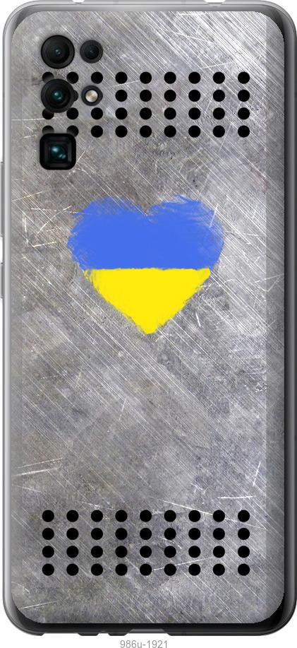 

Чехол на Huawei Honor 30 Щит 2