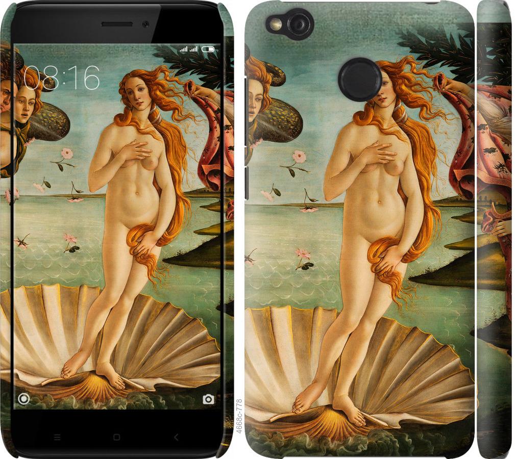 

Чохол на Xiaomi Redmi 4X Венера