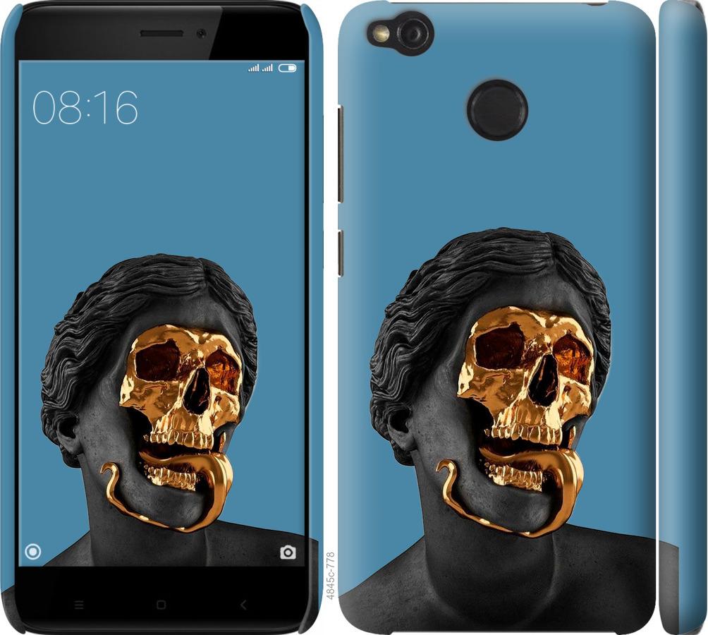 

Чохол на Xiaomi Redmi 4X Sculptures