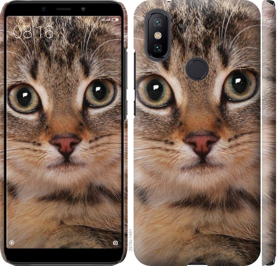 

Чехол на Xiaomi Mi A2 Полосатый котик