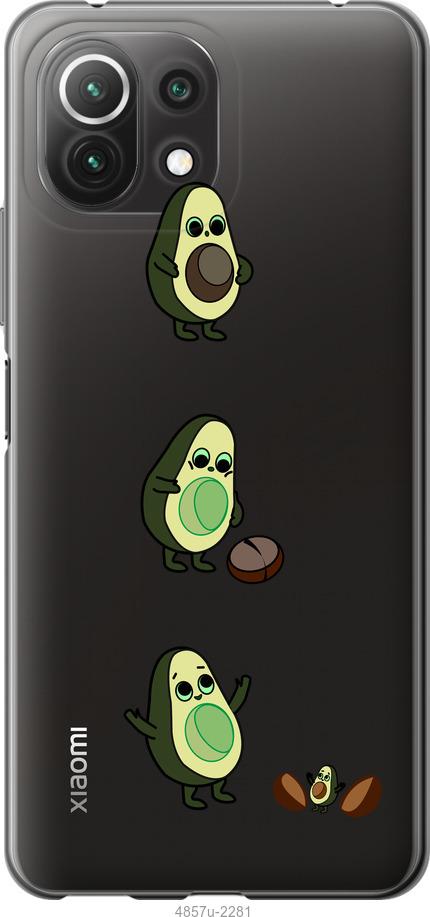 Чехол на Xiaomi Mi 11 Lite Авокадо 1