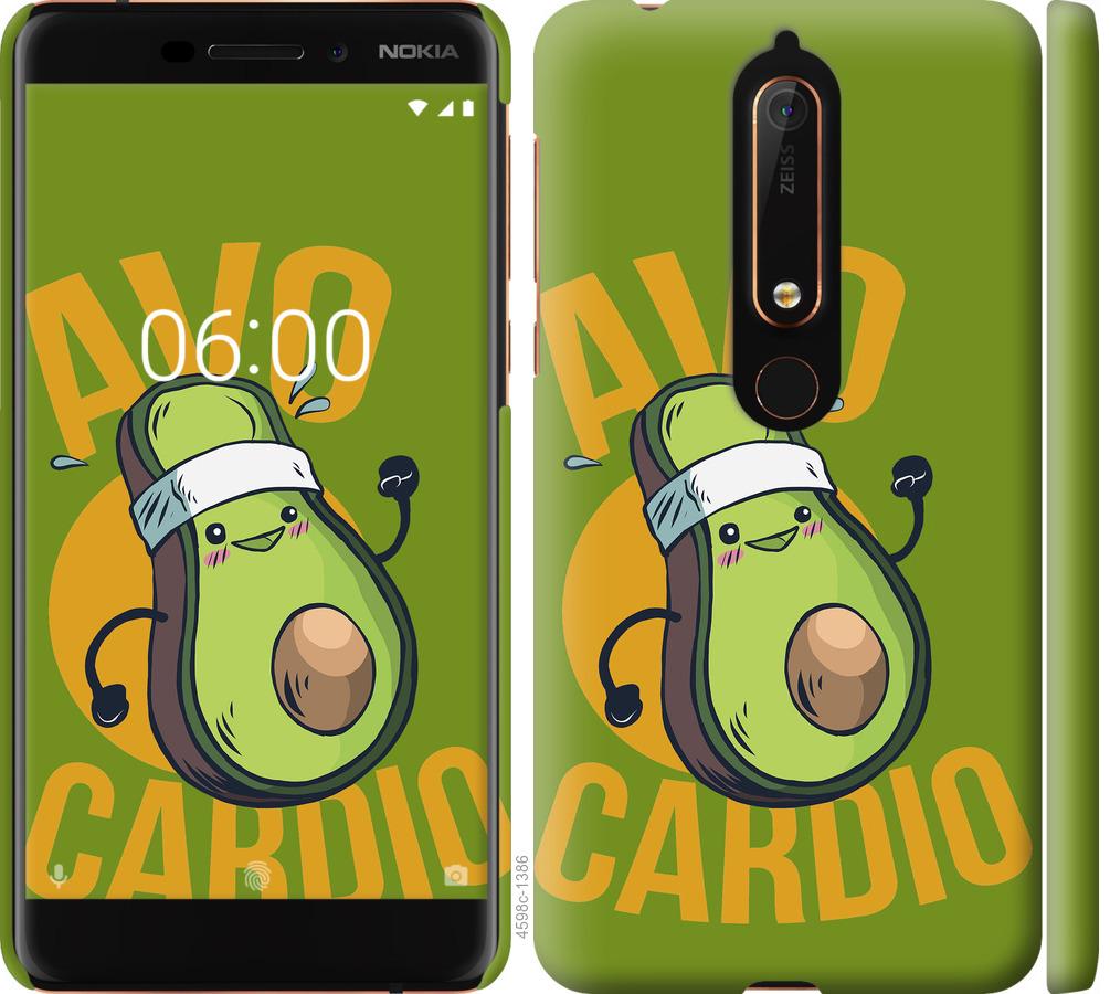 

Чохол на Nokia 6 2018 авокадо