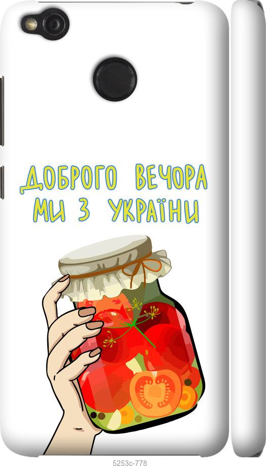 

Чохол на Xiaomi Redmi 4X Ми з України v4