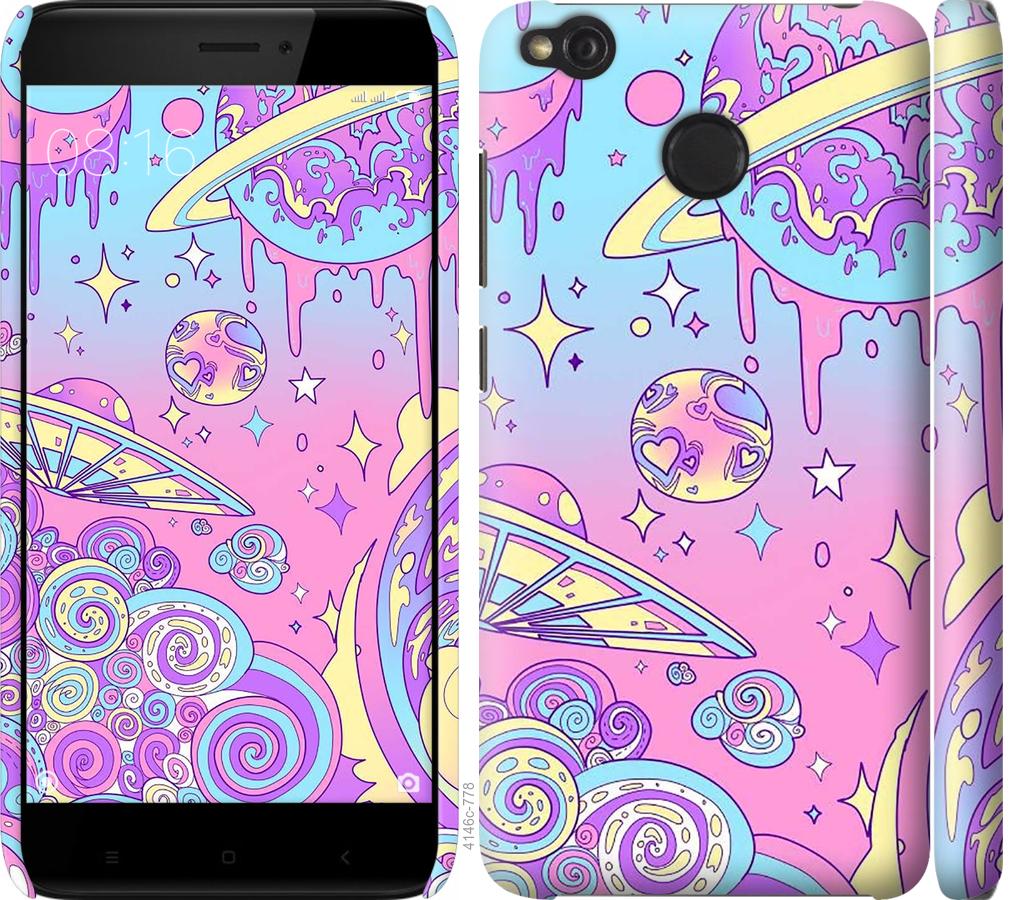 

Чохол на Xiaomi Redmi 4X Рожева галактика