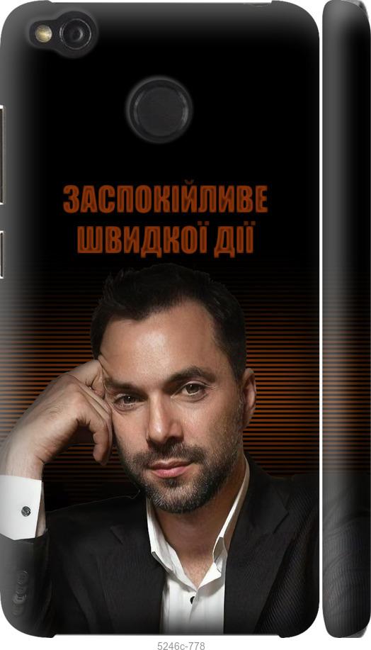 

Чохол на Xiaomi Redmi 4X Заспокійливе