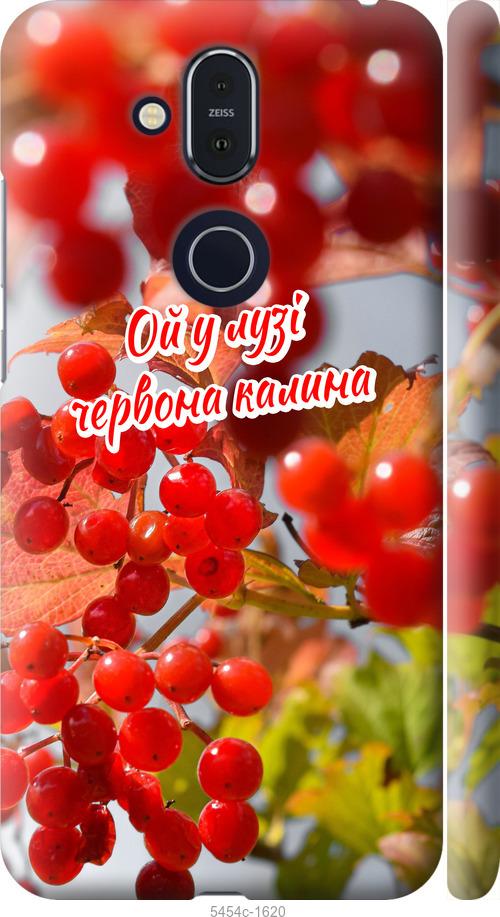 

Чехол на Nokia 8.1 Калина