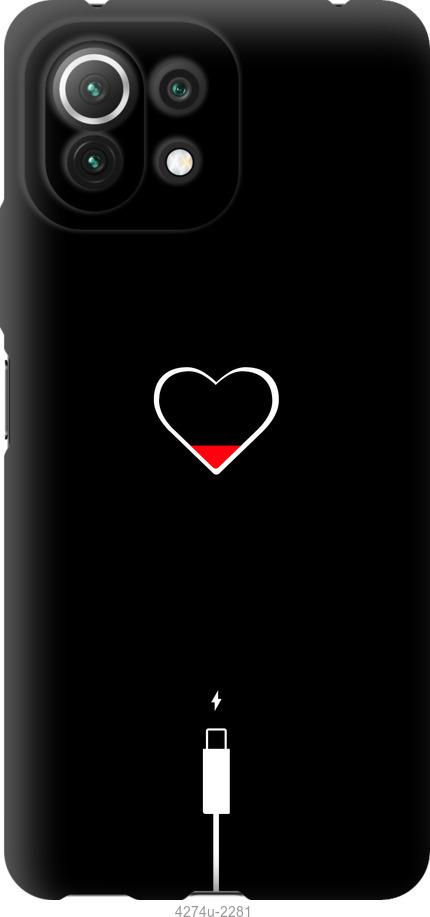 

Чехол на Xiaomi Mi 11 Lite Подзарядка сердца
