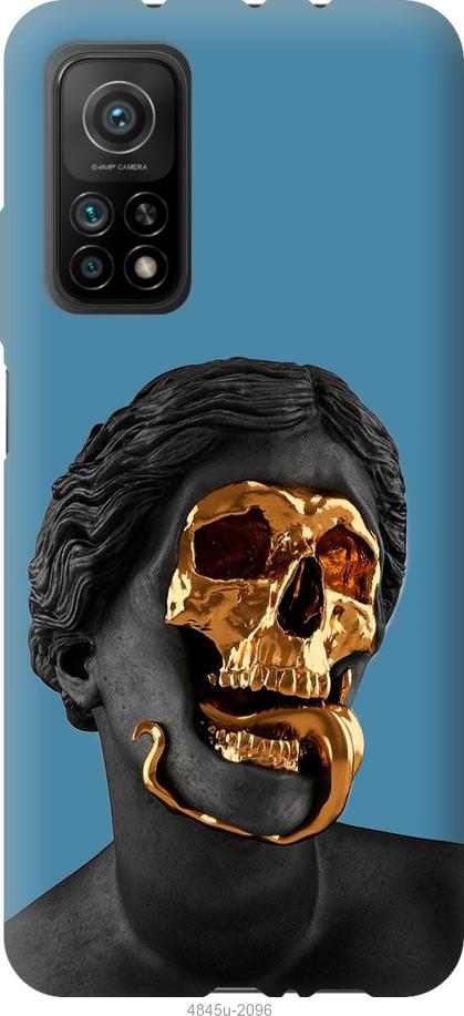 

Чохол на Xiaomi Mi 10T Sculptures