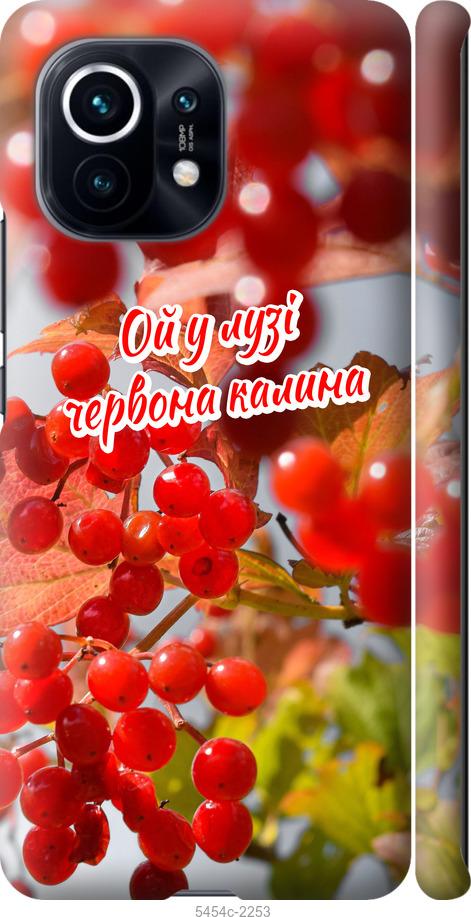 

Чехол на Xiaomi Mi 11 Калина